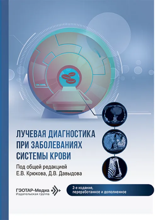 Лучевая диагностика при заболеваниях системы крови