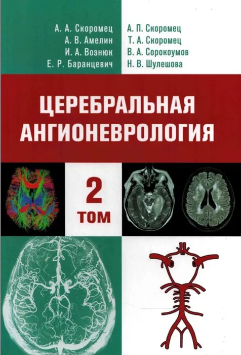 Церебральная ангионеврология