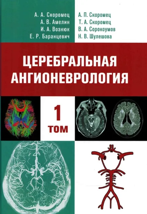 Церебральная ангионеврология