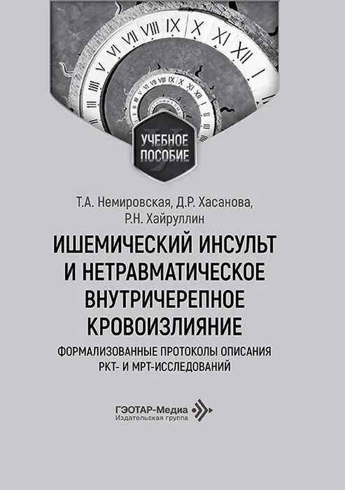 Ишемический инсульт и нетравматическое внутричерепное кровоизлияние
