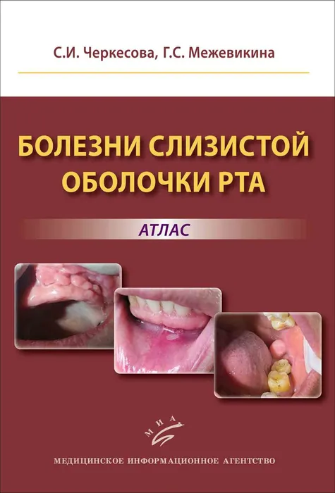 Черкесова, С. И. Болезни слизистой оболочки рта